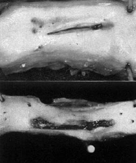 Kísérletes arteriotomia megragasztása