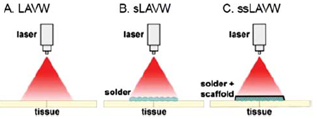 Vázlatos ábra az u.n. solder és scaffold alkalmazásáról
