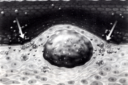 Vascularis integritás és vascularis remodeling