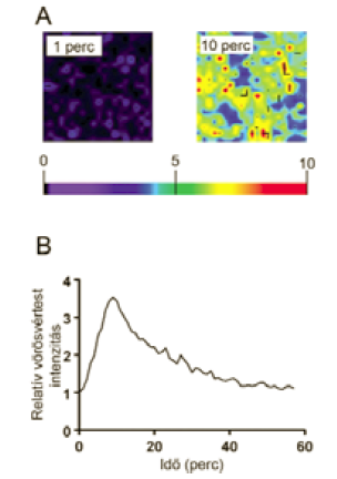 Az S-nitrozoglutation nitrogénmonoxid-donor molekula terápiás alkalmazásainak lehetőségei