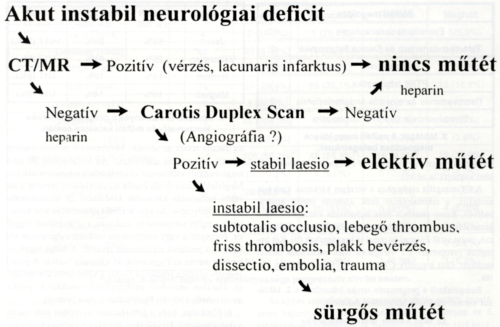 Akut carotis revaszkularizáció progresszív stroke esetén