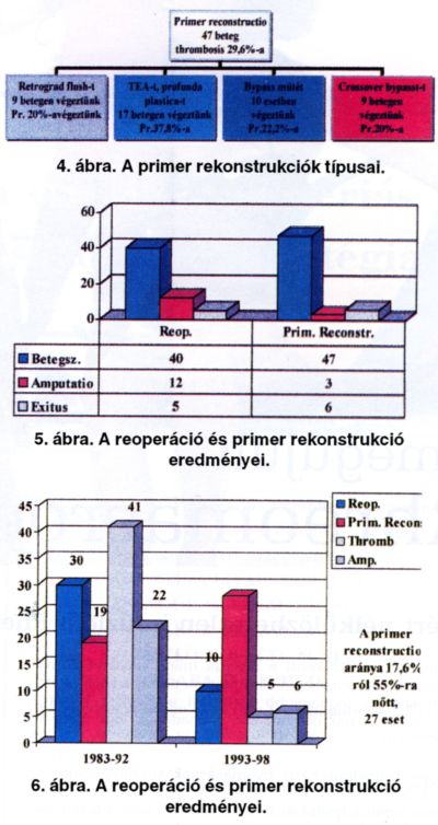 Az alsó végtag embolektómiája, trombektómiája során végzett primer rekonstrukciók és ezt követő reoperációk