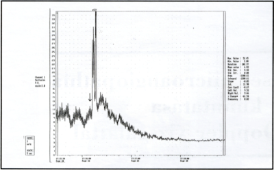 Diabeteses microangiopathia kimutatása laser Doppler vizsgálattal