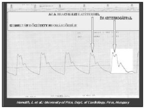 A vérnyomás, az artériás stiffness és más hemodinamikai paraméterek egyidejű mérése