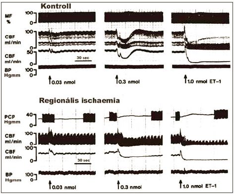 Az endothelin coronariahatás jellemzői regionális myocardialis ischaemiában: kísérletes vizsgálatok