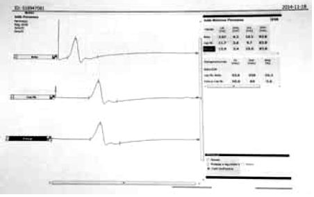 A diabeteses láb komplex vizsgálata