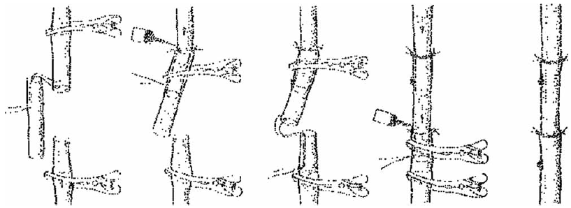 Graft-interpositio ragasztással (Gyurkó munkájából)
