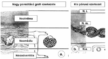A magyarországi érsebészeti kutatások értéke nemzetközi összehasonlításban II. (Magyarok az érsebészet fejlődésének élvonalában)
