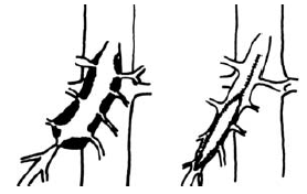 arteria mesenterica superioron