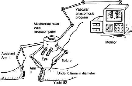 Robot-asszisztált microvascularis érvarrat vázlata