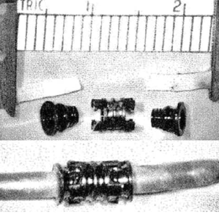 Háromrészes, felszívódó, Vicryl gyűrűs, microvascularis anastomosis.