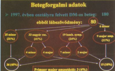 A diabetes-láb trophicus szövődményeinek ellátása
