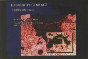 Krónikus sebek kezelése a gyógyulás különböző fázisaiban