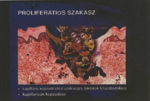 Krónikus sebek kezelése a gyógyulás különböző fázisaiban