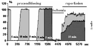 Ischaemiás-reperfúziós károsodás csökkentésének elvi és gyakorlati lehetőségei az érsebészetben. Irodalmi áttekintés.