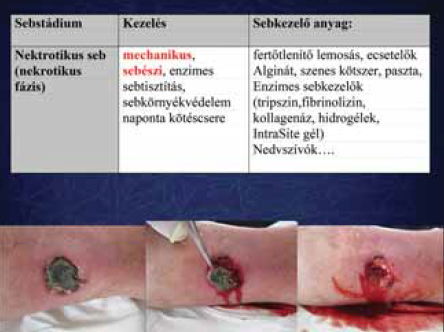 Sebtisztítás