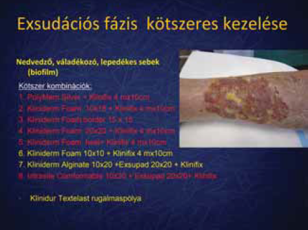 Kötszeres kezelés 1.
