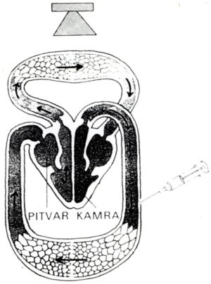 Arteriovenosus shuntök ulcus crurisban
