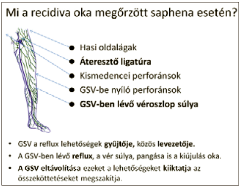 A véna saphena magna megőrzése