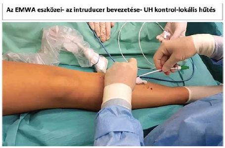 Kezdődik a műtét.