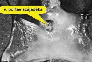 Elektrocoaptive éregyesítés - kombinált eljárások