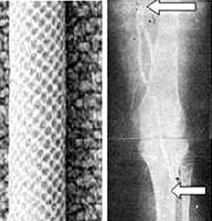 Külföldön élő, magyar származású, érbetegségekkel foglalkozó kutatók és klinikusok
