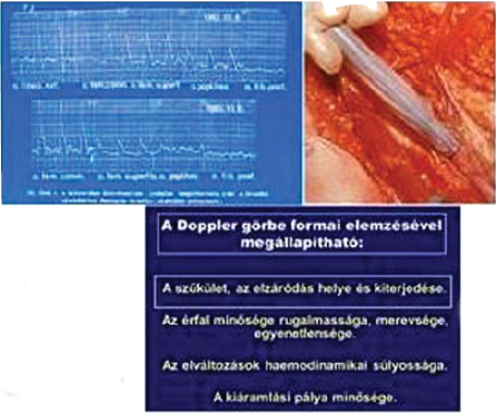 Külföldön élő, magyar származású, érbetegségekkel foglalkozó kutatók és klinikusok