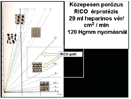 Magyarországi érprotézis kísérletek