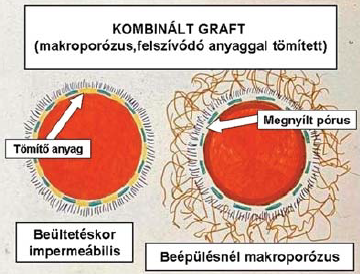 Magyarországi érprotézis kísérletek