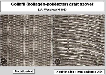 Magyarországi érprotézis kísérletek