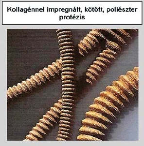 Magyarországi érprotézis kísérletek