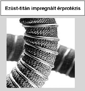 Magyarországi érprotézis kísérletek