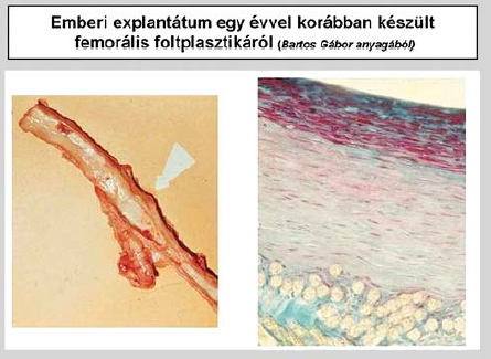 Magyarországi érprotézis kísérletek