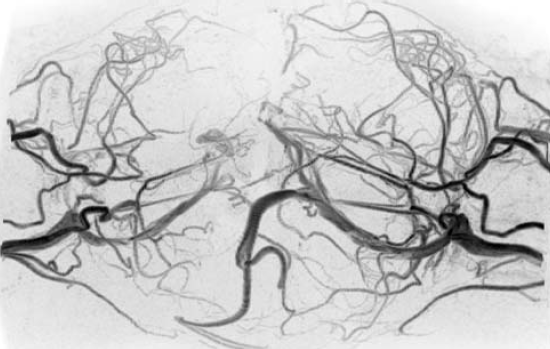 A bangladesi sziámi ikrek szétválasztása A bangladesi sziámi ikrek szétválasztása