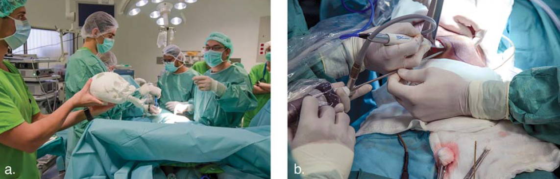 A bangladesi sziámi ikrek szétválasztása A bangladesi sziámi ikrek szétválasztása